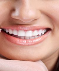 Effective Ways to Treat Overbite with the Help of Invisalign